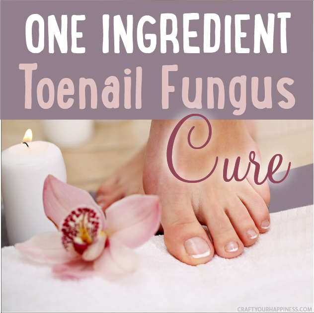 Get rid of icky toenail fungus with our one ingredient toenail fungus cure! We've got a bonus free sachet pattern you can make to keep your shoes fresh.