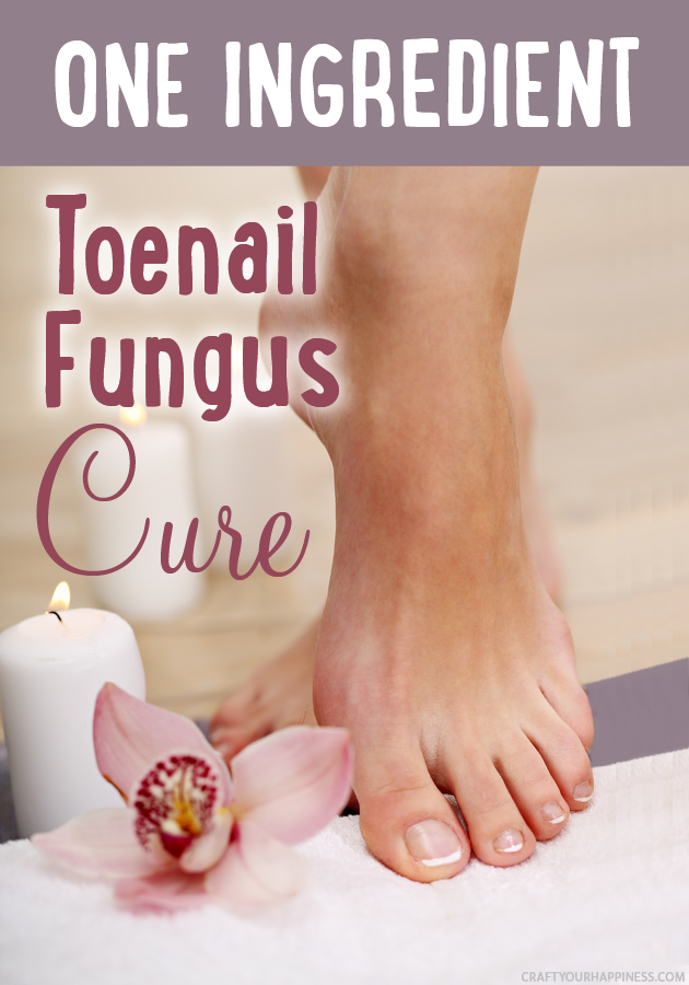 Get rid of icky toenail fungus with our one ingredient toenail fungus cure! We've got a bonus free sachet pattern you can make to keep your shoes fresh.